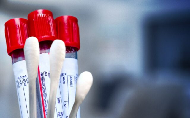 FDA Blocks Critical Rapid COVID-19 Testing